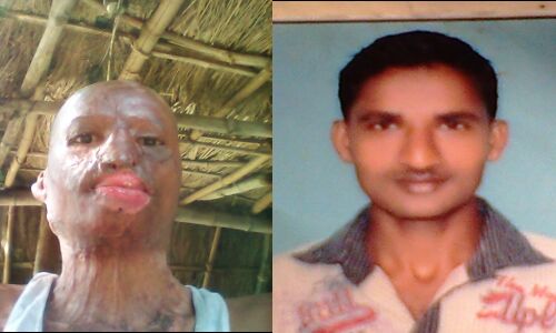 एक तरफ़ा प्यार में पागल युवती ने किया युवक का यह हाल, युवती को किया गिरफ़्तार एक तरफ़ा प्यार में पागल युवती ने किया युवक का यह हाल, युवती को किया गिरफ़्तार