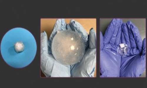 अल्सर, पेट के कैंसर का पता लगाएगी ये नई टैबलेट