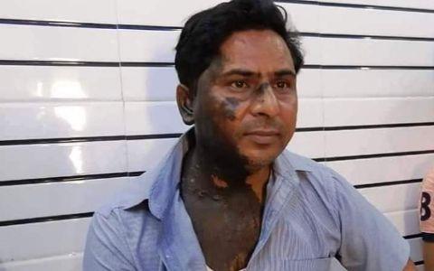 नामचीन उर्दू शायर हाशिम फिरोजाबादी पर एसिड अटैक के मामले में पुलिस ने 2 लोगों को किया गिरफ्तार