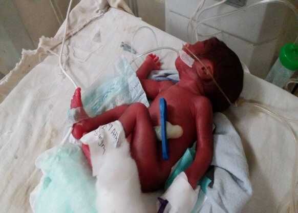 दफनाते ही जीवित हो उठी मासूम, डॉक्टर ने मृत घोषित कर दिया था