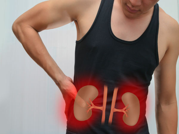 किडनी ट्रांसप्लांट से कैसे बचा जाएँ