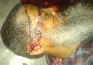 सपा नेता ने की सपा कमेटी संचालक का गोली मारकर हत्या, भीड़ का पुलिस पर हमला