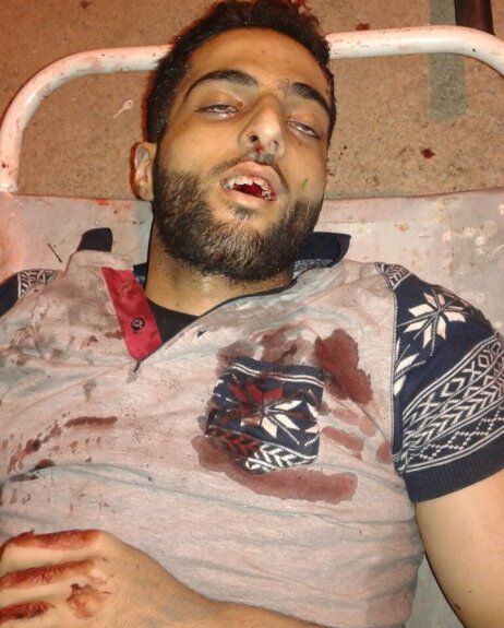 हिजबुल के पोस्टर ब्याय को सेना ने मार कर हिजबुल मुजाहिदीन की कमर तोड़ दी