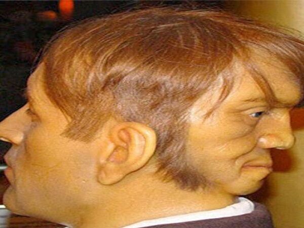 एक शरीर दो चेहरे, एक सोता है तो दूसरा जगता है