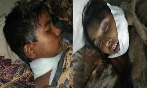 अबैध संबंधों के शक में पत्नी सहित तीन बच्चों को कुल्हाड़ी से काटा,दो बच्चों की मौत अबैध संबंधों के शक में पत्नी सहित तीन बच्चों को कुल्हाड़ी से काटा,दो बच्चों की मौत