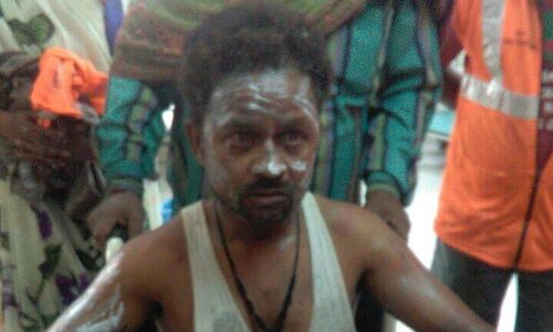 वाराणसी: पितरकुंड स्थित सफाई घर में जबरदस्त विस्फोट,कूड़ा फेंकने आया नगर निगम कर्मी घायल