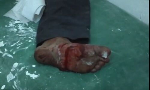 नॉएडा के बाद सुल्तानपुर में इनकाउंटर पर उठा सवाल, क्या यादव होने पर गोली मारी गई? नॉएडा के बाद सुल्तानपुर में इनकाउंटर पर उठा सवाल, क्या यादव होने पर गोली मारी गई?