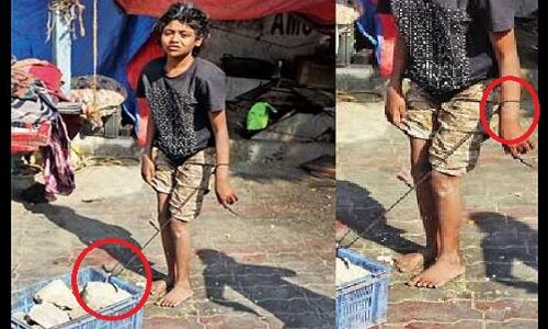 बेटी के साथ कोई रेप ना कर दे इसलिए रखती है जंजीर से बांधकर माँ!