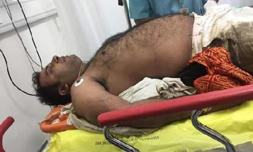 यमुना एक्सप्रेस-वे पर अमित जानी की गाड़ी का एक्सीडेंट, एक की मौत तीन घायल