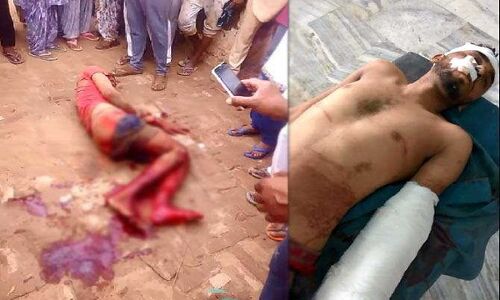 लड़कियों को करता था अश्लील इशारे, लोगों ने काट दिए हाथ-पैर, तड़प-तड़प कर गई जान