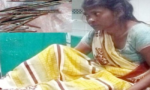 OMG: इस लड़की के पैरों से रोजाना निकल रही लोहे की कीलें, डॉक्टर भी हैं हैरान