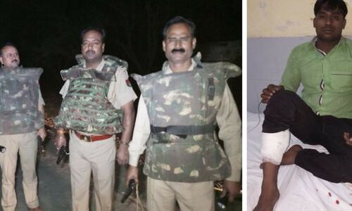 पुलिस मुठभेड़ में गोली लगने से घायल हुआ 25  हजार का इनामी  बदमाश