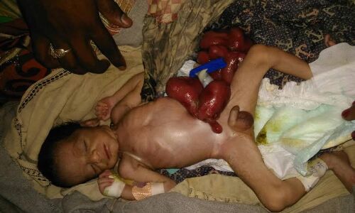 इस नवजात की हालत देख हो जायेंगे हैरान, इलाज के लिए लगाईं गुहार इस नवजात की हालत देख हो जायेंगे हैरान, इलाज के लिए लगाईं गुहार