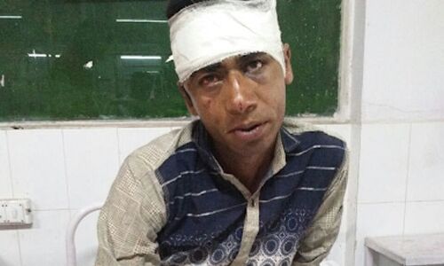 यूपी में रेप से बचने के लिए युवती ने आरोपी का काट डाला लिंग और फिर ....