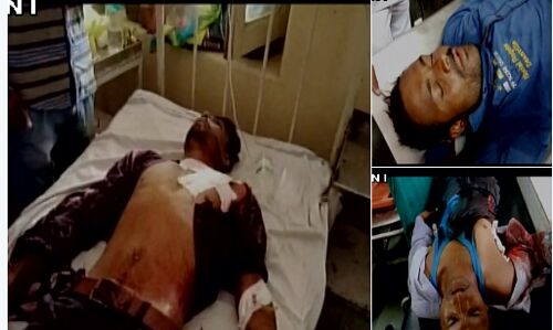 क्या मंदसौर के किसान कश्मीरी पत्थरबाजों से ज्यादा हिंसक हो गए थे ? जो गोली चलानी पड़ी ?