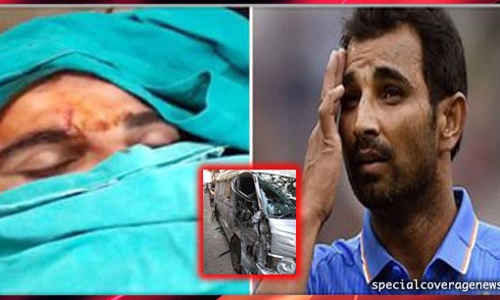 सड़क हादसे के शिकार हुए मोहम्मद शमी, सिर में लगे हैं कई टांके!