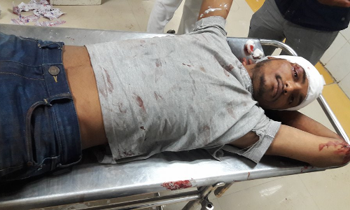 बीएचयू: छात्र गुट भिड़े, चली गोली