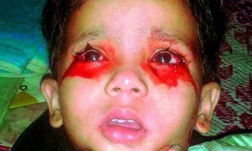 खून के आंसू रोती है ये मासूम, डॉक्टर भी हैरान, पिता ने PM मोदी से मांगी मदद