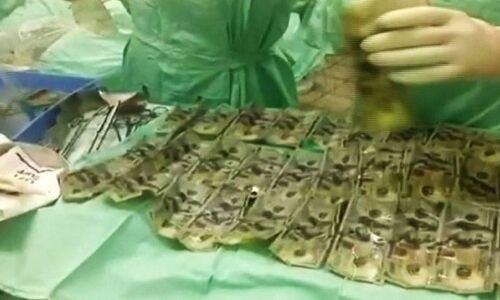 पति को सबक सिखाने के लिए पत्नी ने निगली 4 लाख रुपए के नोट