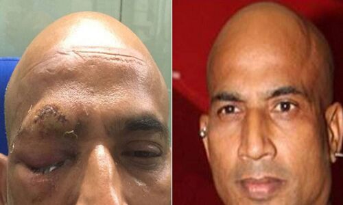 बॉलीवुड actor जीतू वर्मा पर राजस्थान में हुआ हमला, जा सकती है आंख की रोशनी