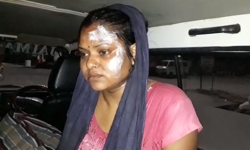 घरेलू विवाद को लेकर महिला पर तेज़ाब डाला,महिला गंभीर रूप से घायल