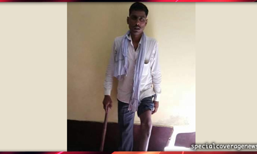 कोटेदार की दवंगई, दिव्यांग को राशन न देकर उसके साथ की मारपीट