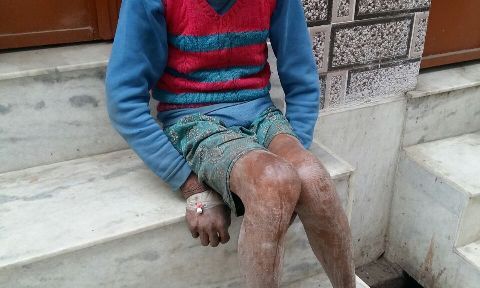 मानवीय सरकार का संवेदन हींन चेहरा, इस बुजुर्ग को अस्पताल बाले इस हाल में छोड़ गये