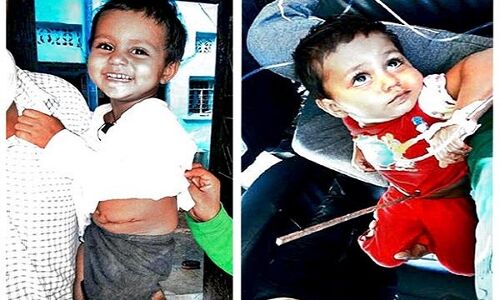 मासूम के पेट में घुसी लोहे की रॉड, बच्ची की हिम्मत देख डॉक्टर भी हैरान