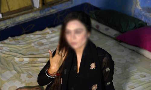 शादी के 18 साल बाद इस औरत ने किया ऐसा काम, परिवार वालों के उड़े होश! शादी के 18 साल बाद इस औरत ने किया ऐसा काम, परिवार वालों के उड़े होश!