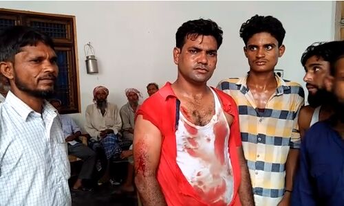 बीबी ने किया अपने बाप को फोन, बाप ने गुंडा लाकर जमकर की दामाद की धुनाई बीबी ने किया अपने बाप को फोन, बाप ने गुंडा लाकर जमकर की दामाद की धुनाई