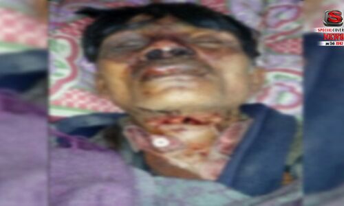 हरदोई : पैसे के लेन देन के विवाद में युवक की काटी गर्दन, गंभीर घायल हरदोई : पैसे के लेन देन के विवाद में युवक की काटी गर्दन, गंभीर घायल