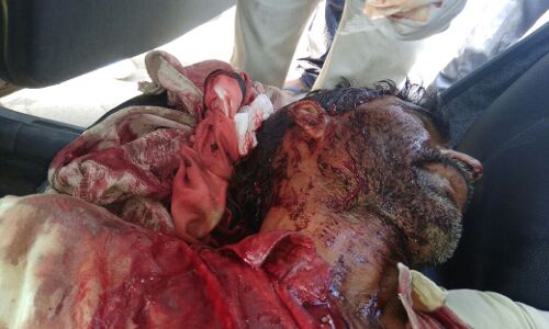 हरदोई: पुलिस की लापरवाही से एक किसान की फावड़े से काटा, मरणासन्न हालत में अस्पताल भेजा