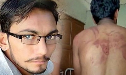 स्टाइलिश मूंछ रखने पर दलित युवक को बुरी तरह पीटा, FIR दर्ज