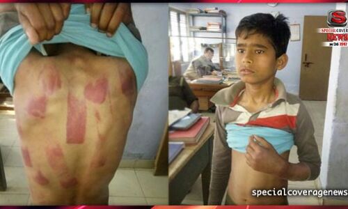 सौतेली मां के अत्याचार से परेशान बच्चे को मदद की दरकार सौतेली मां के अत्याचार से परेशान बच्चे को मदद की दरकार