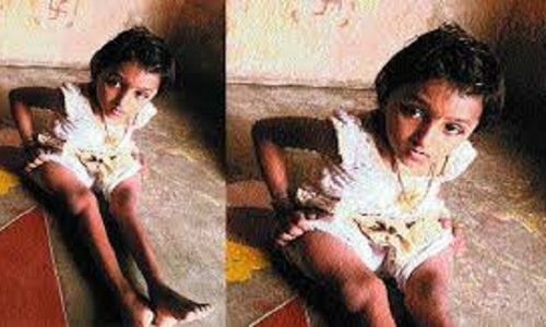 9 साल की लक्ष्मी की 13 बार टूट चुकी है हड्डियां, फिर भी मुस्कान के साथ लड़ रही जिंदगी की जंग! 9 साल की लक्ष्मी की 13 बार टूट चुकी है हड्डियां, फिर भी मुस्कान के साथ लड़ रही जिंदगी की जंग!