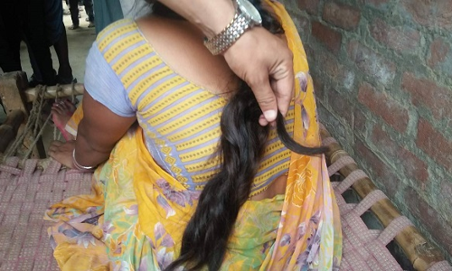 रहस्यमय ढंग से कटी महिला की चोटी, बेहोश हालत में हुई स्वास्थ्य केंद्र में भर्ती