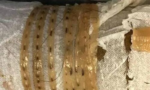 एक शख्स रोज खाता था मछली , जानिए फिर क्या हुआ एक शख्स रोज खाता था मछली , जानिए फिर क्या हुआ