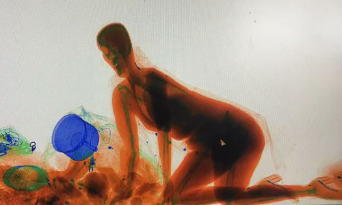 VIDEO: जब X-Ray मशीन के अंदर घुस गई लड़की, वजह जानकर आप भी हो जाएंगे हैरान