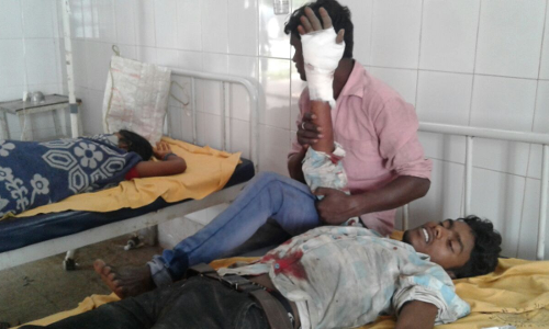 छठ घाट पर बैलून फुलाने वाले टंकी में विस्फोट, दो गंभीर रूप से जख्मी