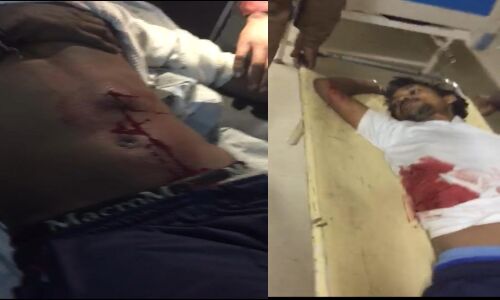 प्रयागराज में दो लोंगों को गोली मार दी है प्रयागराज में दो लोंगों को गोली मार दी है