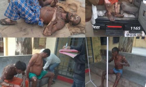 त्रिवेणी फैक्ट्री में अज्ञात कारणों से लगी आग,  लगभग एक दर्जन मजदूर झुलसे, कुछ की हालत गंभीर,