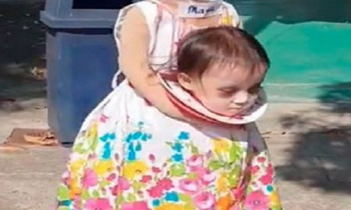 हैरतअंगेज VIDEO: अपना ही कटा सिर लेकर सड़क पर घूम रही थी बच्ची, लोगों की अटक गई सांसें!