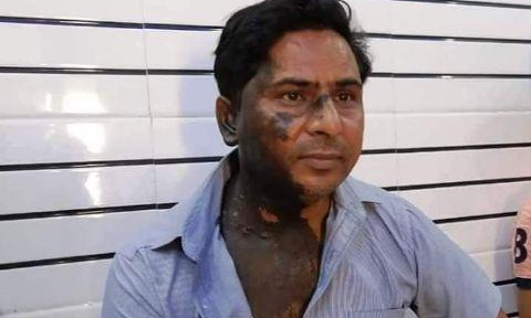 नामचीन उर्दू शायर हाशिम फिरोजाबादी पर एसिड अटैक के मामले में पुलिस ने 2 लोगों को किया गिरफ्तार