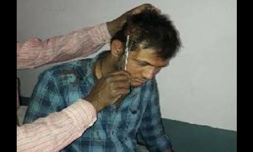 BHU: कर्तव्य पूछने पर भड़के डाक्टर,मरीज की जान लेने पर तुल गए BHU: कर्तव्य पूछने पर भड़के डाक्टर,मरीज की जान लेने पर तुल गए