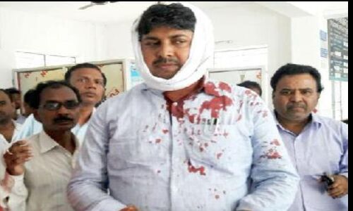 सिवान में बीडीओ पर जानलेवा हमला, बीजेपी सांसद बोले सिवान में अब ....?