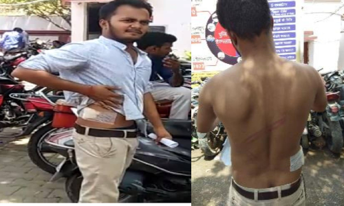 BHU में बवाल: चला चाकू हुआ पथराव