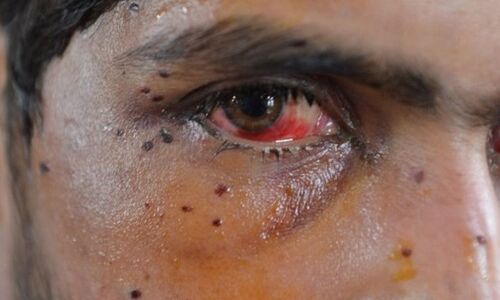 सेना बखूबी करे पैलेटगन का जम्मू कश्मीर में प्रयोग - हाईकोर्ट