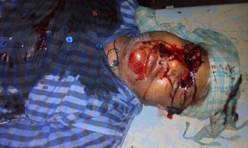 सरेशाम व्यवसाई के सिर में मारी गोली, व्यवसाई की मौत सरेशाम व्यवसाई के सिर में मारी गोली, व्यवसाई की मौत