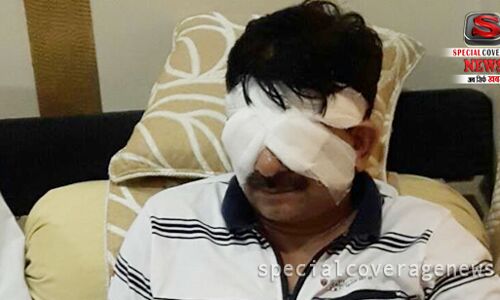 मुजफ्फरनगर : बीजेपी विधायक की आँखों में मिर्ची डालकर भागे युवक