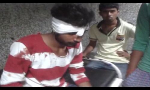 पटना: कालेज में गेंगवार, छात्र नेता को मारी दिनदहाड़े मारी गोली